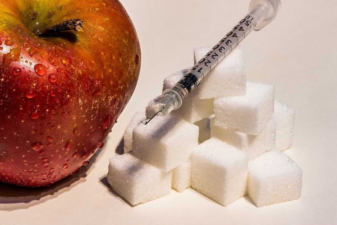 Il diabete mellito si sviluppa sullo sfondo della mancanza di insulina e un aumento del glucosio nel sangue
